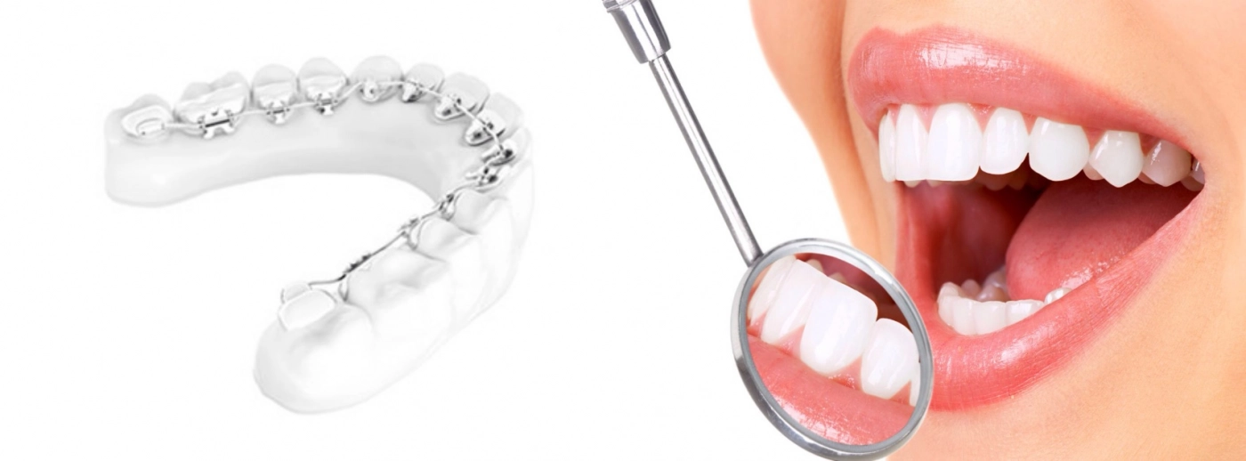 Dentalux